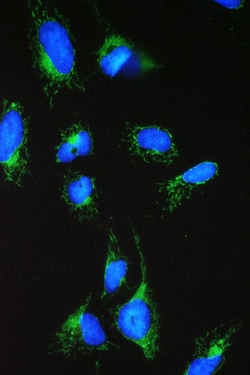 Invitrogen ACAA2 Polyclonal Antibody 100 &mu;g; Unconjugated:Antibodies,