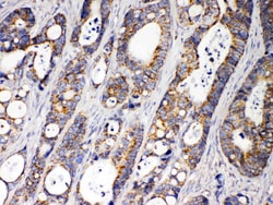 Invitrogen ACAA2 Polyclonal Antibody 100 &mu;g; Unconjugated:Antibodies,