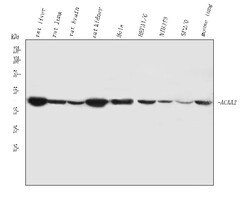 Invitrogen ACAA2 Polyclonal Antibody 100 &mu;g; Unconjugated:Antibodies,