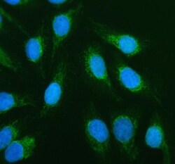 Invitrogen ACADVL Polyclonal Antibody 100 &mu;g; Unconjugated:Antibodies,