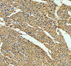 Invitrogen ACADVL Polyclonal Antibody 100 &mu;g; Unconjugated:Antibodies,