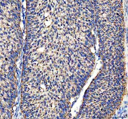 Invitrogen ACADVL Polyclonal Antibody 100 &mu;g; Unconjugated:Antibodies,