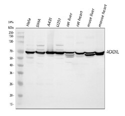 Invitrogen ACADVL Polyclonal Antibody 100 &mu;g; Unconjugated:Antibodies,