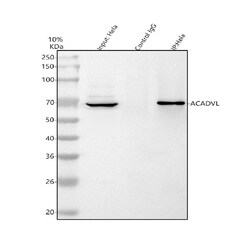 Invitrogen ACADVL Polyclonal Antibody 100 &mu;g; Unconjugated:Antibodies,