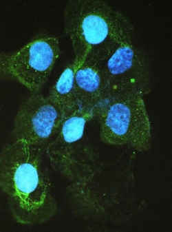 Invitrogen ACE Polyclonal Antibody 100 &mu;g; Unconjugated:Antibodies,