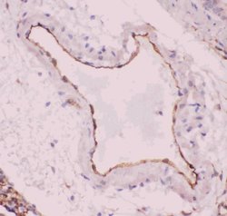 Invitrogen ACE Polyclonal Antibody 100 &mu;g; Unconjugated:Antibodies,