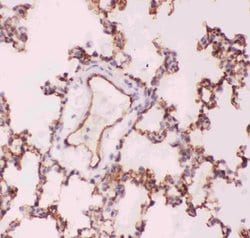 Invitrogen ACE Polyclonal Antibody 100 &mu;g; Unconjugated:Antibodies,