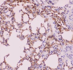 Invitrogen ACE Polyclonal Antibody 100 &mu;g; Unconjugated:Antibodies,