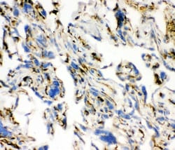 Invitrogen ACE Polyclonal Antibody 100 &mu;g; Unconjugated:Antibodies,