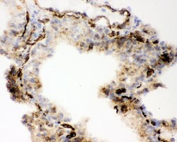 Invitrogen ACE Polyclonal Antibody 100 &mu;g; Unconjugated:Antibodies,