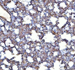 Invitrogen ACE Polyclonal Antibody 100 &mu;g; Unconjugated:Antibodies,