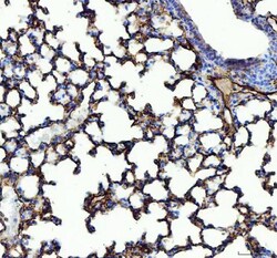 Invitrogen ACE Polyclonal Antibody 100 &mu;g; Unconjugated:Antibodies,