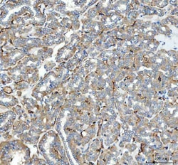 Invitrogen ACE Polyclonal Antibody 100 &mu;g; Unconjugated:Antibodies,
