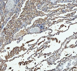 Invitrogen ACE Polyclonal Antibody 100 &mu;g; Unconjugated:Antibodies,