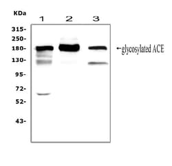 Invitrogen ACE Polyclonal Antibody 100 &mu;g; Unconjugated:Antibodies,