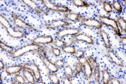 Invitrogen ACSL1 Polyclonal Antibody 100 &mu;g; Unconjugated:Antibodies,