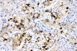 Invitrogen ACSL1 Polyclonal Antibody 100 &mu;g; Unconjugated:Antibodies,