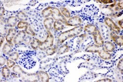 Invitrogen ACSL1 Polyclonal Antibody 100 &mu;g; Unconjugated:Antibodies,