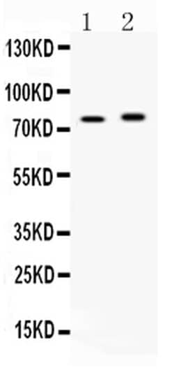 Invitrogen ACSL5 Polyclonal Antibody 100 &mu;g; Unconjugated:Antibodies,