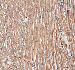 Invitrogen ACTA1 Polyclonal Antibody 100 &mu;g; Unconjugated:Antibodies,