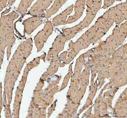 Invitrogen ACTA1 Polyclonal Antibody 100 &mu;g; Unconjugated:Antibodies,