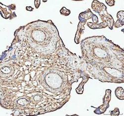 Invitrogen ACTA1 Polyclonal Antibody 100 &mu;g; Unconjugated:Antibodies,