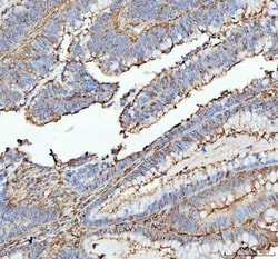 Invitrogen ACTA1 Polyclonal Antibody 100 &mu;g; Unconjugated:Antibodies,