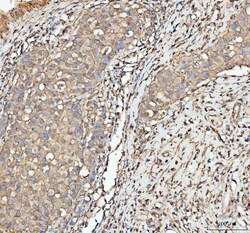 Invitrogen ACTA1 Polyclonal Antibody 100 &mu;g; Unconjugated:Antibodies,