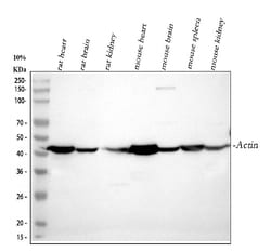 Invitrogen ACTA1 Polyclonal Antibody 100 &mu;g; Unconjugated:Antibodies,