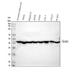Invitrogen ACTA1 Polyclonal Antibody 100 &mu;g; Unconjugated:Antibodies,