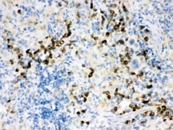 Invitrogen ACTA1 Polyclonal Antibody 100 &mu;g; Unconjugated:Antibodies,