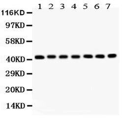 Invitrogen ACTA1 Polyclonal Antibody 100 &mu;g; Unconjugated:Antibodies,