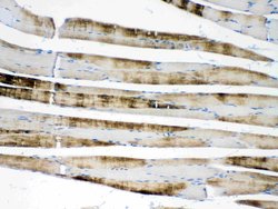 Invitrogen alpha Actinin 3 Polyclonal Antibody 100 &mu;g; Unconjugated:Antibodies,
