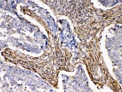 Invitrogen alpha Actinin 3 Polyclonal Antibody 100 &mu;g; Unconjugated:Antibodies,