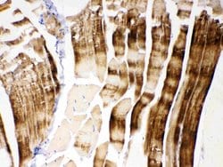 Invitrogen alpha Actinin 3 Polyclonal Antibody 100 &mu;g; Unconjugated:Antibodies,