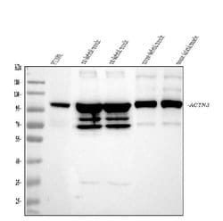 Invitrogen alpha Actinin 3 Polyclonal Antibody 100 &mu;g; Unconjugated:Antibodies,