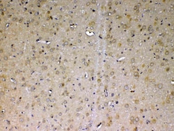 Invitrogen Adenosine Deaminase Polyclonal Antibody 100 &mu;g | Buy Online | Invitrogen&trade; | Fisher Scientific