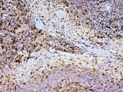 Invitrogen Adenosine Deaminase Polyclonal Antibody 100 &mu;g | Buy Online | Invitrogen&trade; | Fisher Scientific
