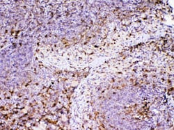Invitrogen Adenosine Deaminase Polyclonal Antibody 100 &mu;g | Buy Online | Invitrogen&trade; | Fisher Scientific