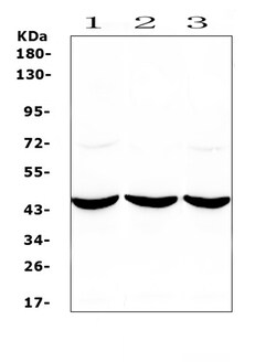 Invitrogen Adenosine Deaminase Polyclonal Antibody 100 &mu;g | Buy Online | Invitrogen&trade; | Fisher Scientific