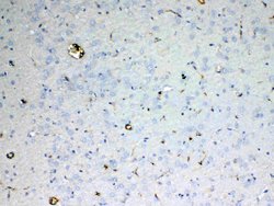 Invitrogen Adenosine Deaminase Polyclonal Antibody 100 &mu;g; Unconjugated:Antibodies,