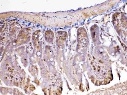 Invitrogen Adenosine Deaminase Polyclonal Antibody 100 &mu;g; Unconjugated:Antibodies,
