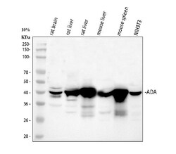 Invitrogen Adenosine Deaminase Polyclonal Antibody 100 &mu;g; Unconjugated:Antibodies,