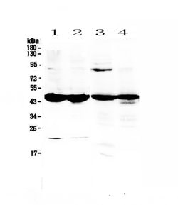 Invitrogen Adenosine Deaminase Polyclonal Antibody 100 &mu;g; Unconjugated:Antibodies,