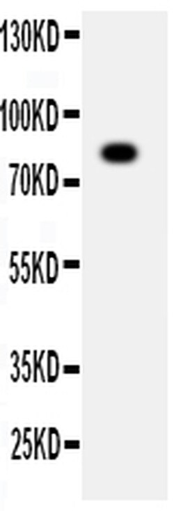Invitrogen ADAM2 Polyclonal Antibody 100 &mu;g; Unconjugated:Antibodies,
