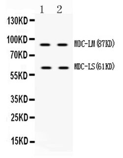 Invitrogen ADAM28 Polyclonal Antibody 100 &mu;g; Unconjugated:Antibodies,