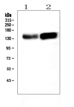 Invitrogen ADAMTS13 Polyclonal Antibody 100 &mu;g; Unconjugated:Antibodies,