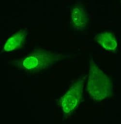 Invitrogen ADK Polyclonal Antibody 100 &mu;g; Unconjugated:Antibodies,