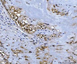 Invitrogen ADK Polyclonal Antibody 100 &mu;g; Unconjugated:Antibodies,