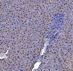 Invitrogen ADK Polyclonal Antibody 100 &mu;g; Unconjugated:Antibodies,